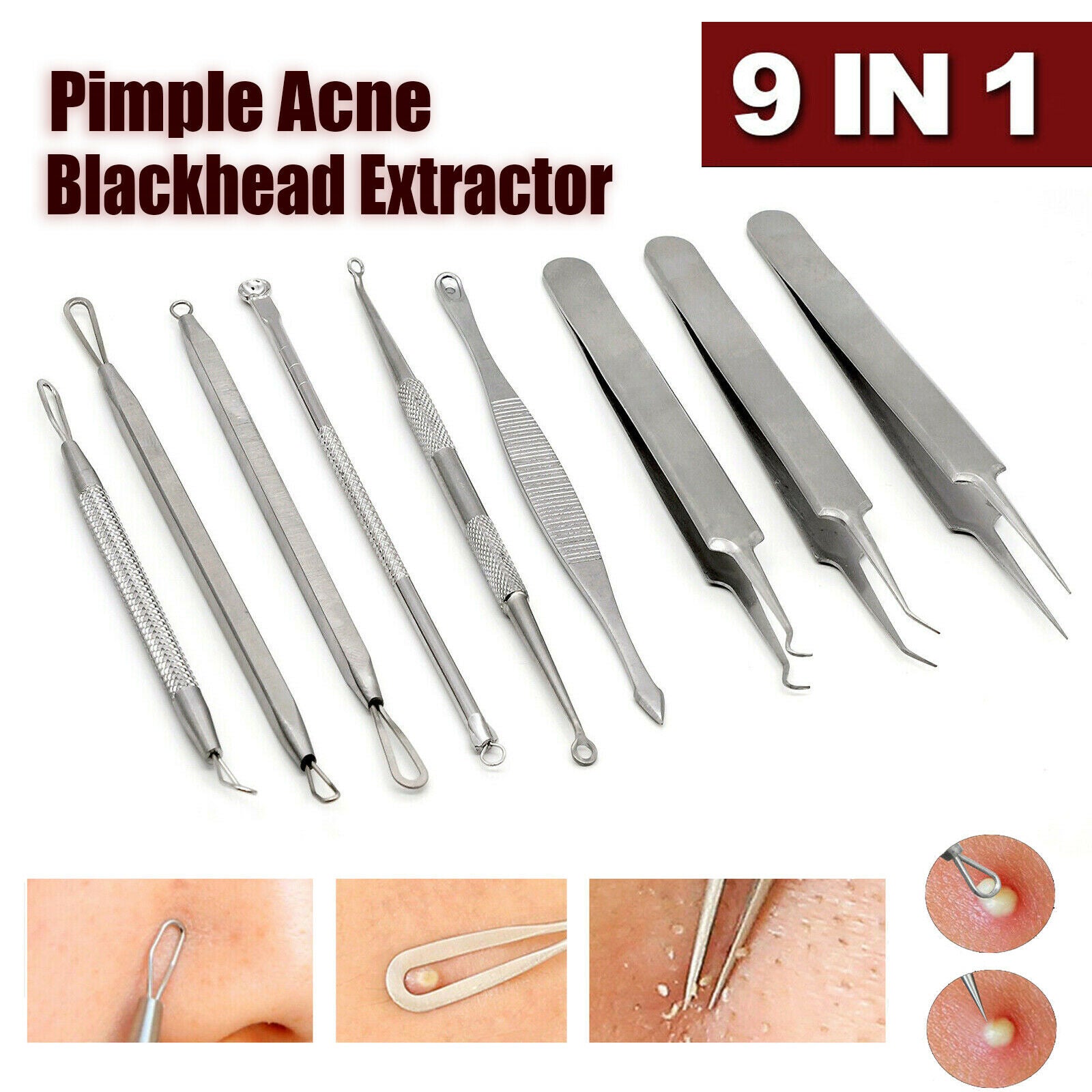 9pcs Set Blackhead Extractor
