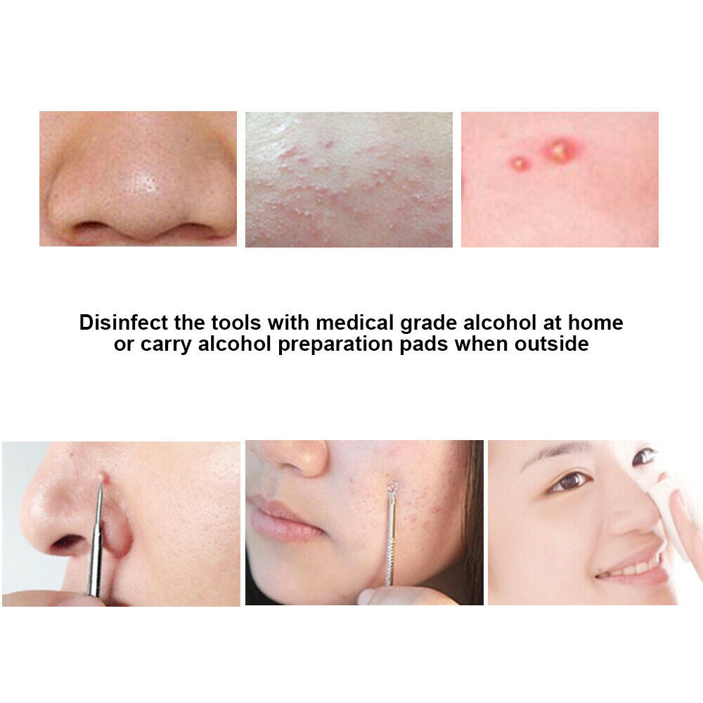 9pcs Set Blackhead Extractor